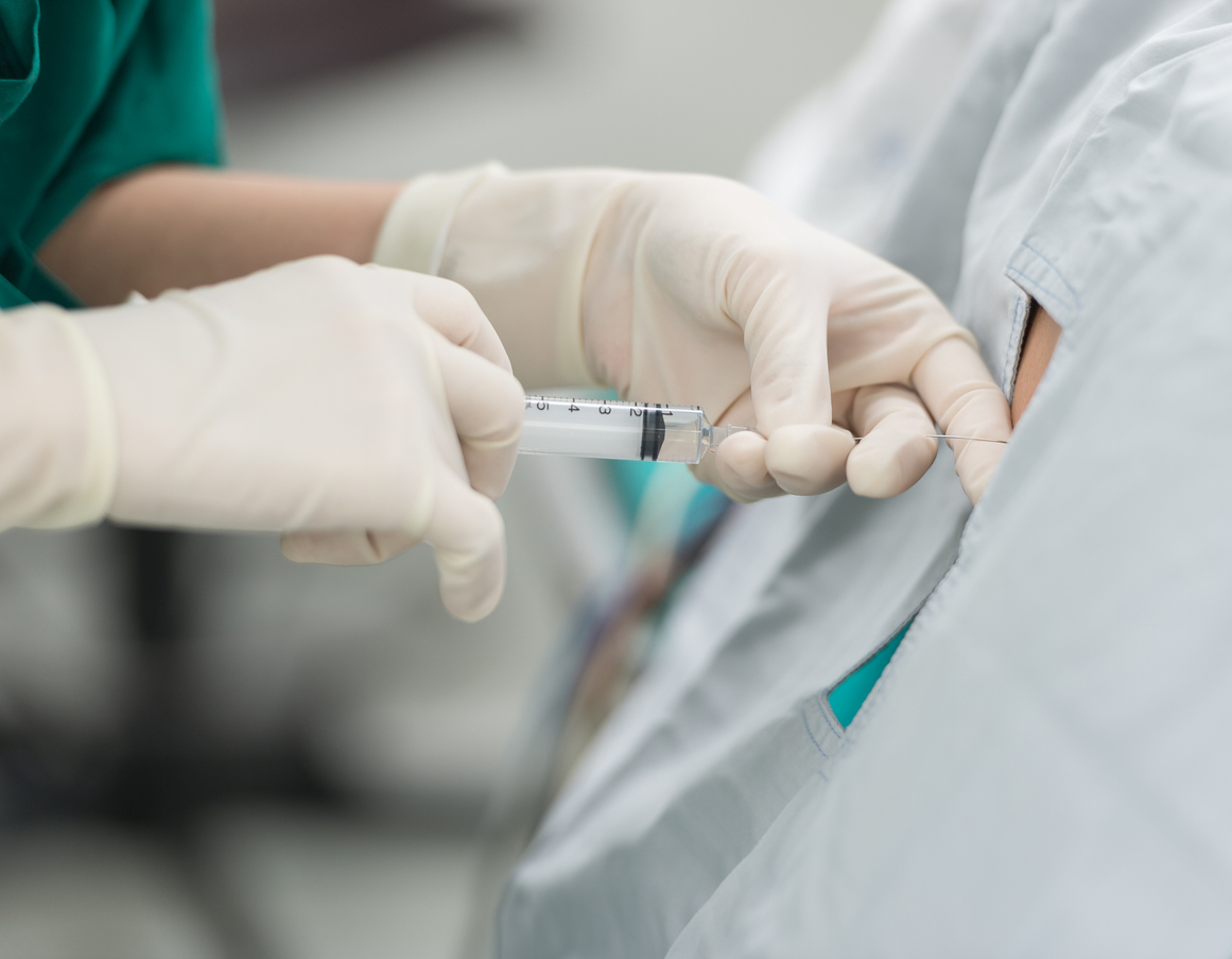 Medical professional performing a lumbar epidural injection for chronic lower back pain relief.